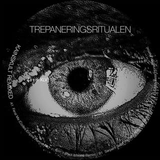 Trepaneringsritualen